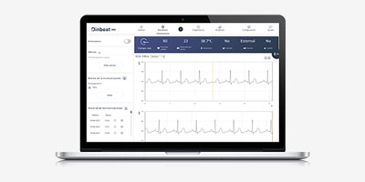 software_DinbeatUNO