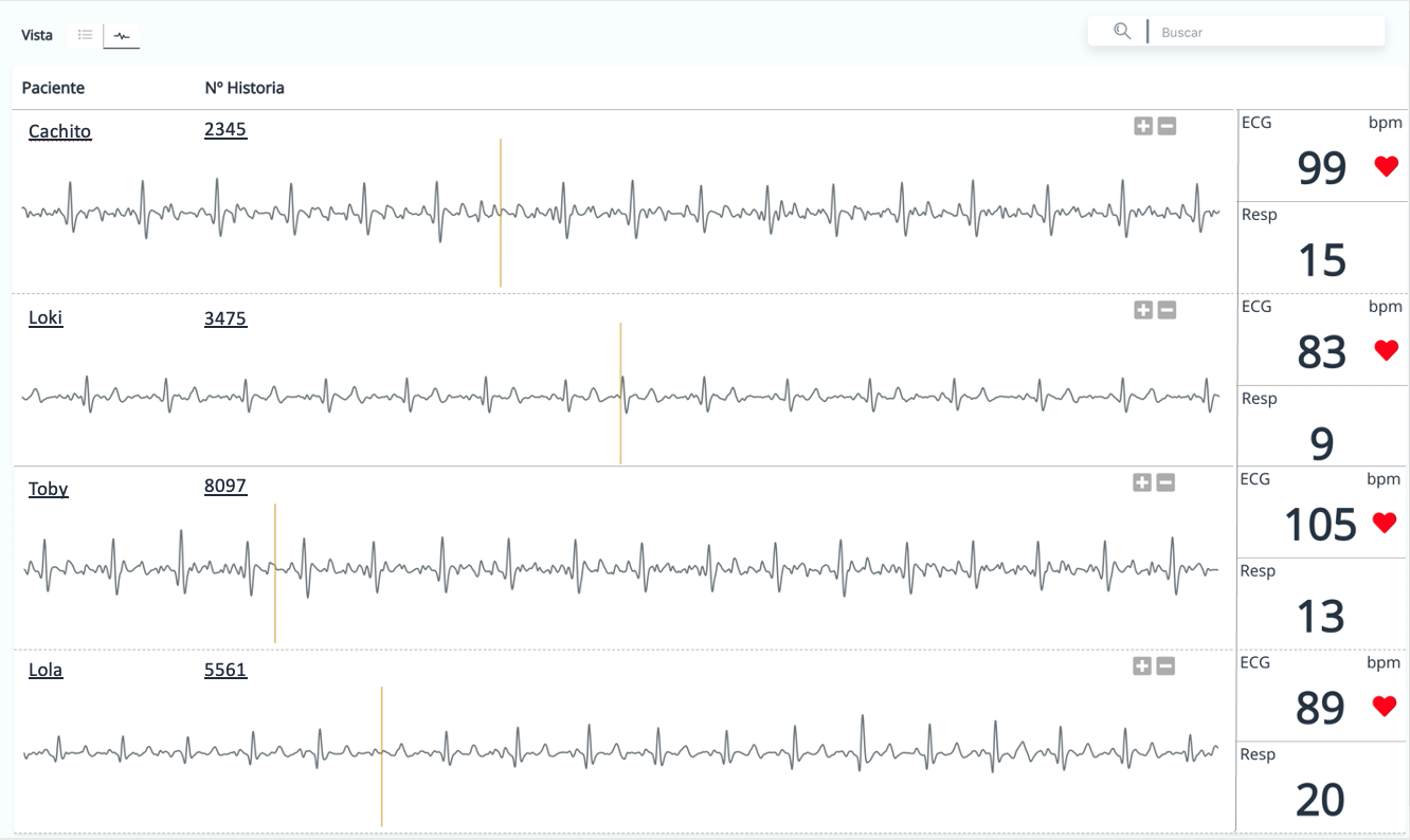 Dinbeat UNO_varios ecg
