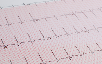 Los diferentes filtros de ECG que dispone Dinbeat UNO